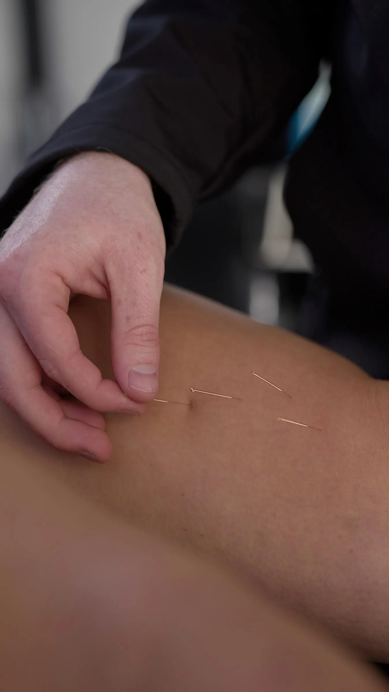 Treatment for Shoulder Pain at Olympus Lifestyle Co